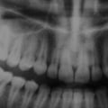 Unveiling the Different Types of Tests Used to Analyze Dental Evidence in Court