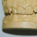 Unveiling the Mysteries of Forensic Odontology in Solving Crimes