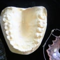 Unveiling the Secrets of Forensic Odontology
