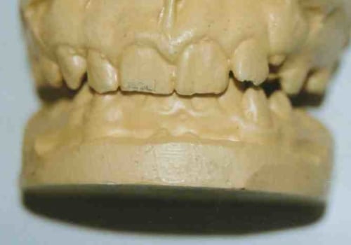 Unveiling the Mysteries of Forensic Odontology in Solving Crimes