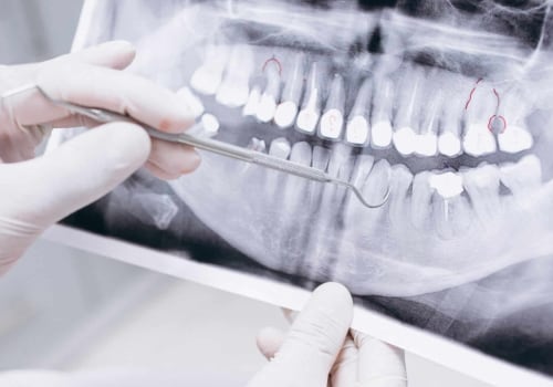 What is the Difference Between Dentists and Odontologists?